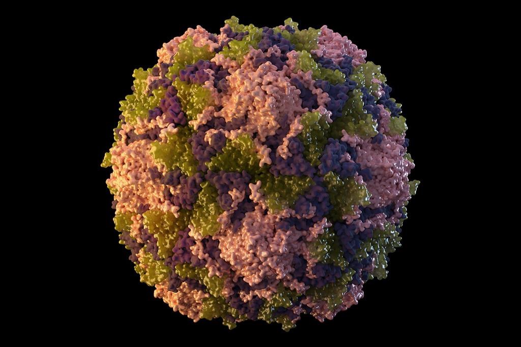 Le virus de la poliomyélite a été détecté dans les eaux usées de New York